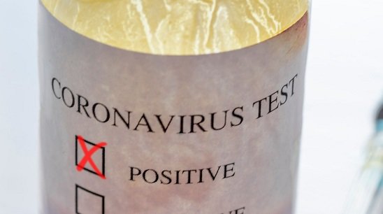Últimos datos del coronavirus en Galicia hoy 