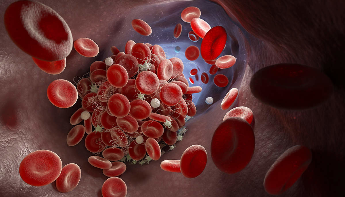 El potencial del plasma rico en plaquetas en traumatología y cirugía ortopédica.